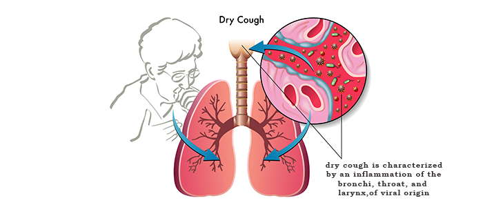 Top 10 Dry Cough Syrups: Benefits and Uses