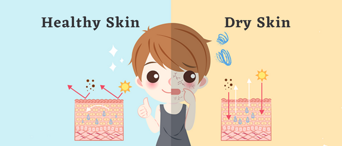Dry skin during winter: an overview