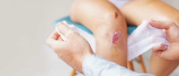 Infected Wound Symptoms and Treatment